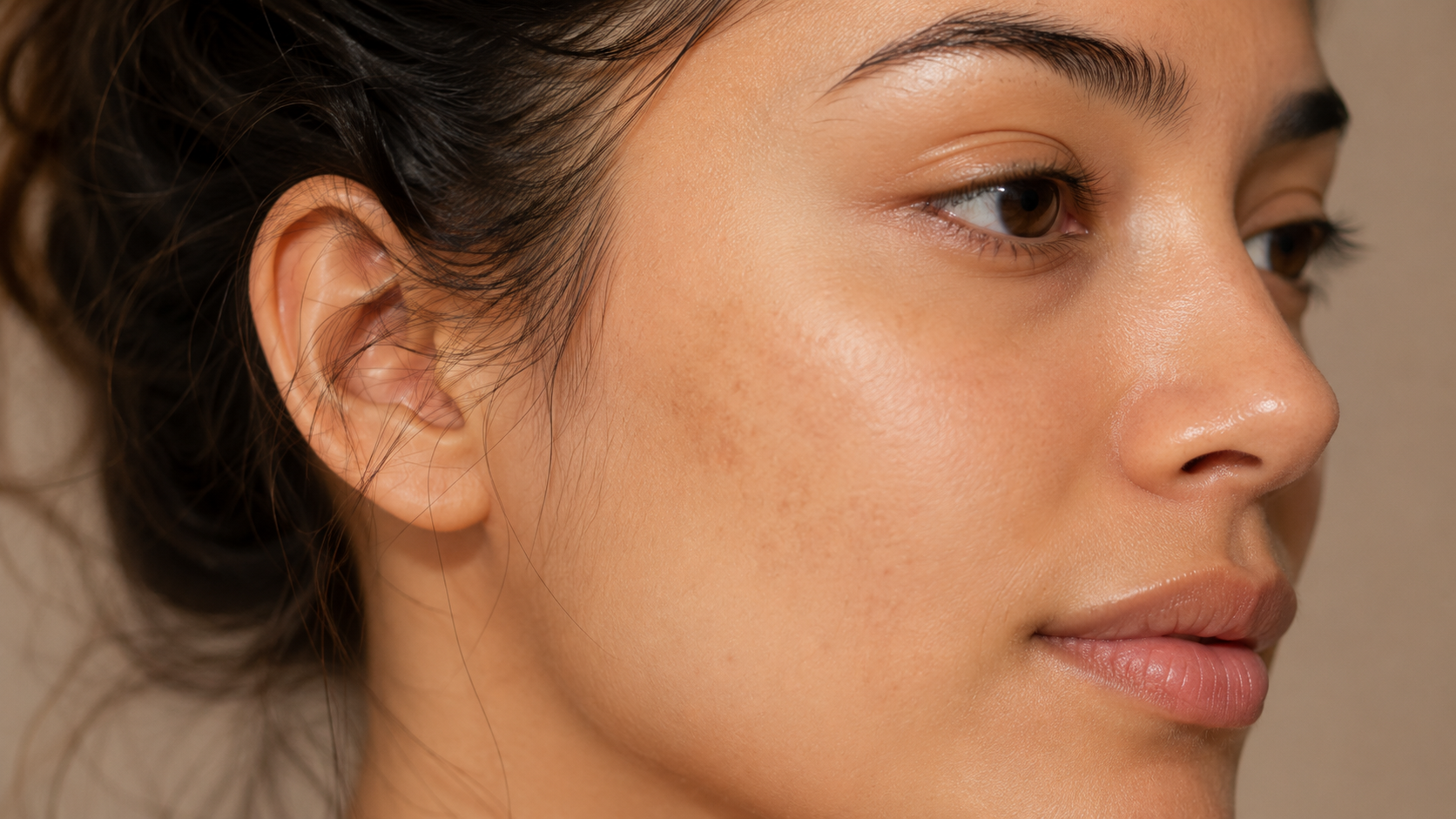 manchas escuras na pele causadas por hiperpigmentação e melasma