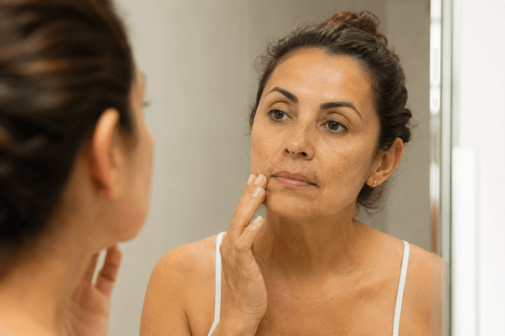 melasma na menopausa mulher observando manchas no rosto