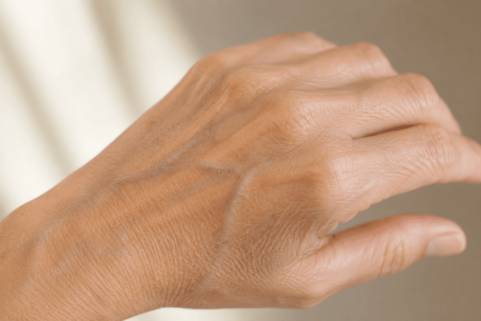 pele fina na menopausa maos com veias visiveis sinais